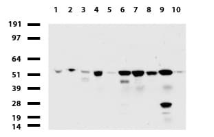 TP / Thymidine Phosphorylase Antibody (aa311-482, clone UMAB97, Carrier-free)