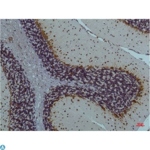 Monoclonal Mouse anti-Human CaMKII Beta+Gamma+Delta Antibody (IHC)