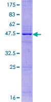 Human IL25 / IL17E Protein (Recombinant GST)