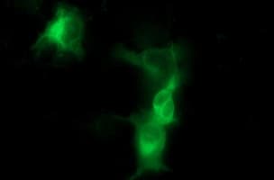 TH / Tyrosine Hydroxylase Antibody (clone OTI2E6)