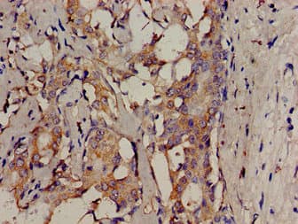 SRMS Antibody