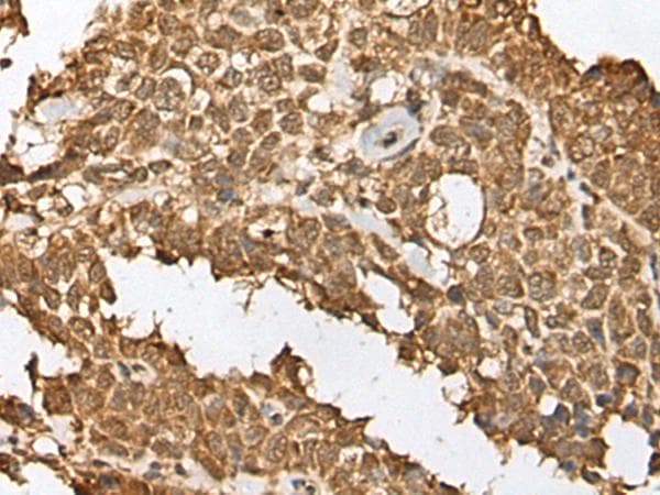 RBL2 / RB2 p130 Antibody