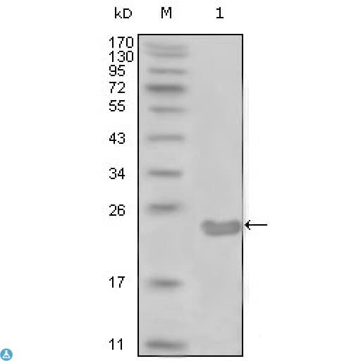 MME / CD10 Antibody