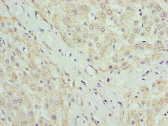 Polyclonal Rabbit anti-Human CLYBL Antibody (IHC, WB)