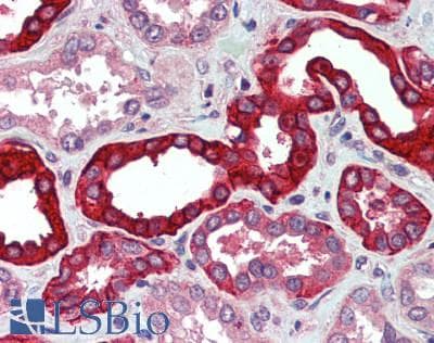 IHC-plus™ SLC8A1 / NCX1 Antibody