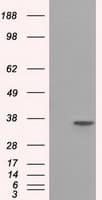 SRR / Serine Racemase Antibody (clone OTI7G6)