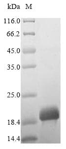 Tyrophagus putrescentiae DERP2 Protein (Recombinant 6His, N-terminus)