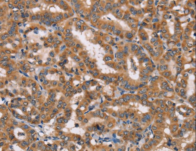 HTR3C / 5-HT3C Receptor Antibody