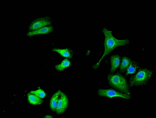 UBQLN1 / Ubiquilin Antibody