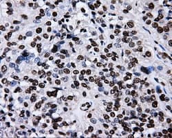 Monoclonal Mouse anti-Human RIP1 / RALBP1 Antibody (clone OTI11B2, IHC, IF, WB)
