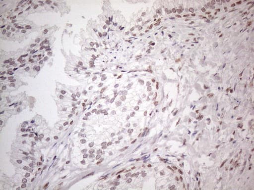 NR2C2 / TAK1 Antibody (aa1-241, clone OTI4B1)