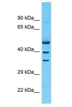 ZNF528 Antibody (aa191-240)