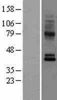 CCR10 / GPR2 Protein (Over-Expression Lysate Myc-DDK (Flag))