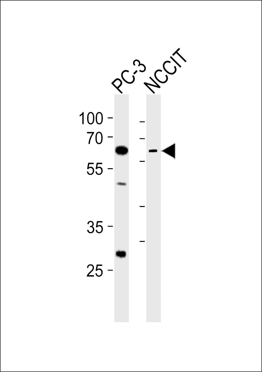 Polyclonal Rabbit anti-Human TBX22 Antibody (aa491-525, WB)