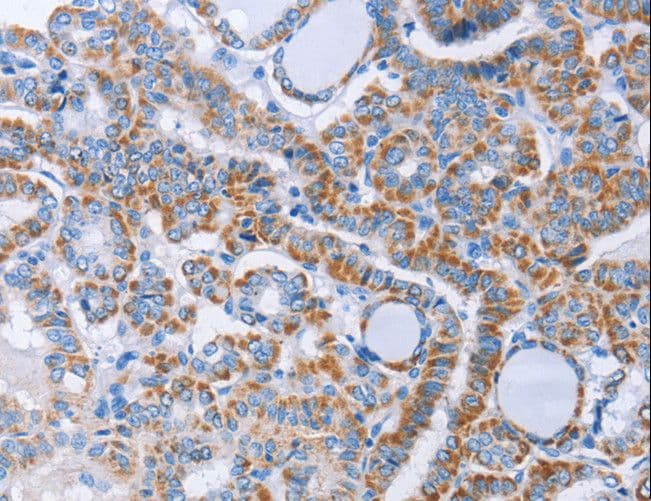 KIF3A Antibody