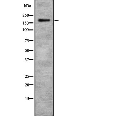 CHD1 Antibody