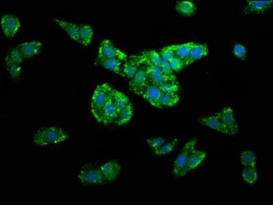 Polyclonal Rabbit anti-Human DLST / E2 Antibody (IHC, IF, WB)