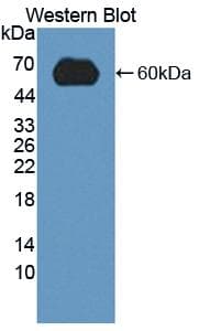 LDLR / LDL Receptor Antibody (aa263-509)