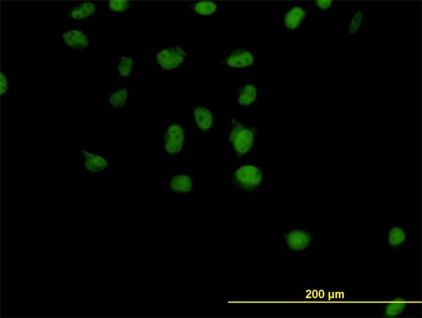 IHC-plus™ Monoclonal Mouse anti-Human CSE1L Antibody (clone 2F4, IHC, IF, WB)