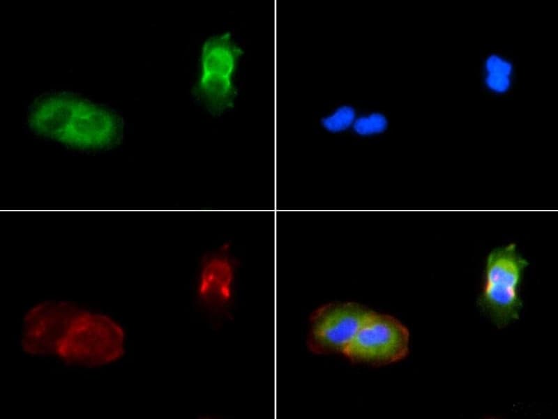 Polyclonal Rabbit anti-Human PIEZO1 / FAM38A Antibody (IHC)