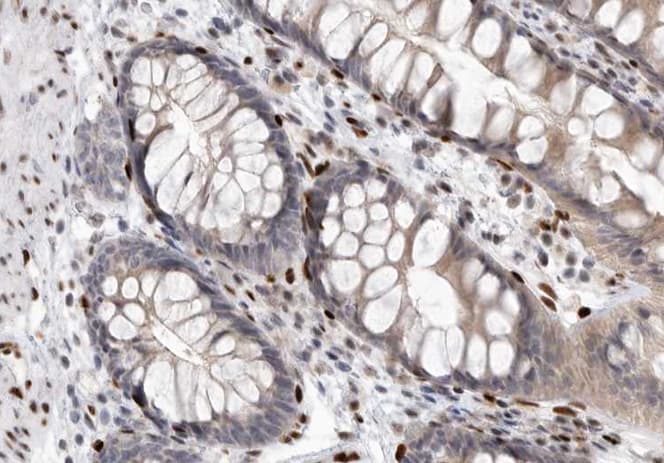 EIF4E Antibody (phospho-Ser209)