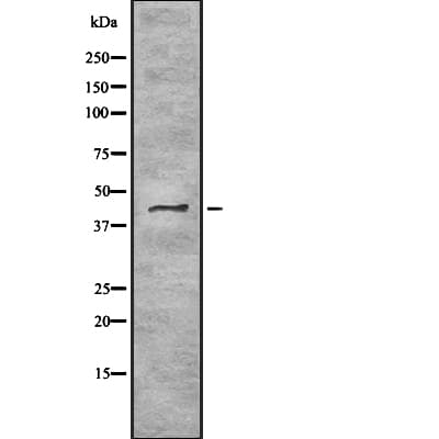 Polyclonal Rabbit anti-Human TRAM2 Antibody (IHC, WB)