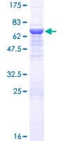 Human HPS3 Protein (Recombinant GST)