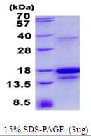 Human PDGF-D Protein (Recombinant His)