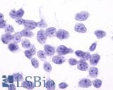 PathPlus™ FP / PTGFR Antibody (Extracellular Domain)