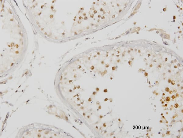 IRAK4 / IRAK-4 Antibody (clone 2D3)
