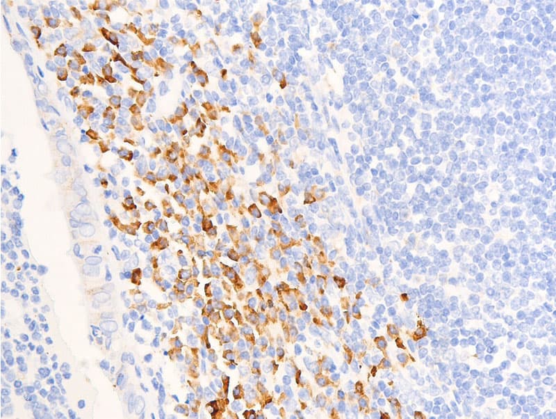 NR3C1/Glucocorticoid Receptor Antibody (phospho-Ser211)