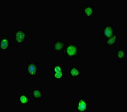 MORC1 Antibody
