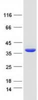 Human C1orf222 Protein (Recombinant Myc-DDK (Flag))