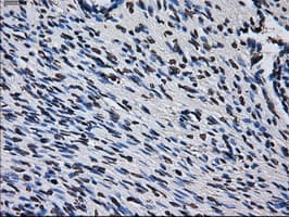 RPA2 / RFA2 / RPA34 Antibody (clone OTI1H10)