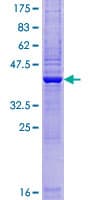 Human ZBTB8OS Protein (Recombinant GST)