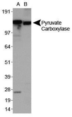 PC / Pyruvate Carboxylase Antibody (aa930-1050, DY650)