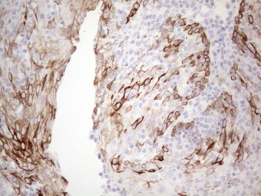 KRT19 / CK19 / Cytokeratin 19 Antibody (aa240-390, clone UMAB187, Carrier-free)