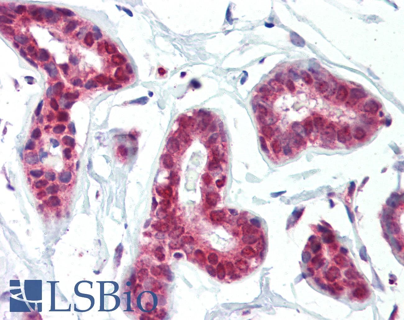 IHC-plus™ PRMT1 Antibody (aa317-346)