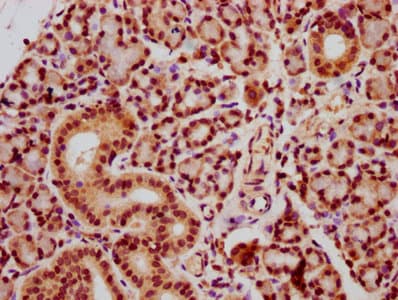 HIST1H2AI Antibody