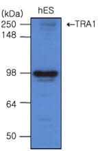 IHC-plus™ Monoclonal Mouse anti-Human HSP90B1 / GP96 / GRP94 Antibody (clone 2H3, aa676-803, IHC, IF, WB)