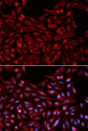 NR1I3 / CAR Antibody