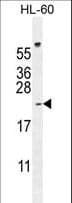 PLA2G2C Antibody (aa113-141)