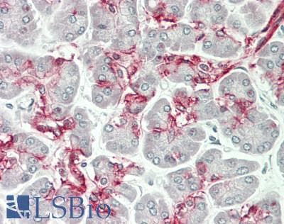 IHC-plus™ SLC4A7 Antibody (aa516-555)