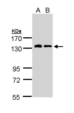 Polyclonal Rabbit anti-Human NPRA / NPR1 Antibody (IHC, IF, WB)
