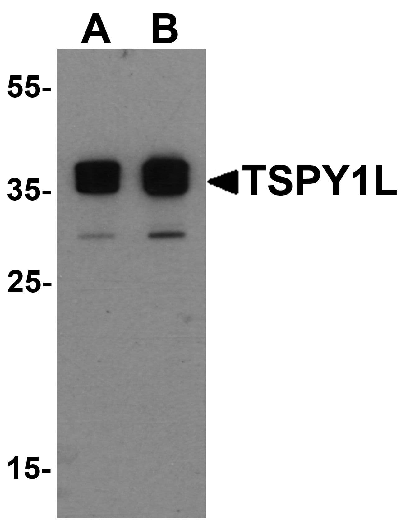 IHC-plus™ Polyclonal Rabbit anti-Human TSPY1 / TSPY Antibody (IHC, WB)