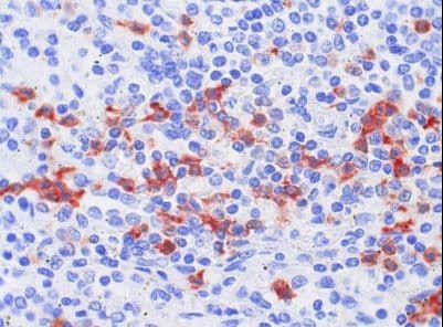 S100A8 / MRP8 Antibody (clone 8-5C2)