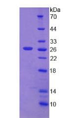 Human DSP / Desmoplakin Protein (Recombinant His)