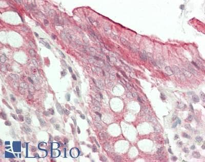IHC-plus™ EPHB4 / EPH Receptor B4 Antibody (aa580-630)