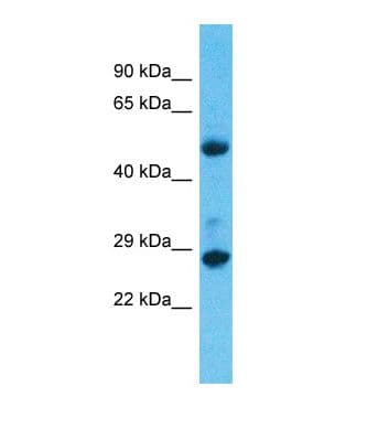 Polyclonal Rabbit anti-Human MED6 Antibody (C-Terminus, WB)