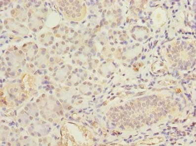Carom / FCHSD2 Antibody